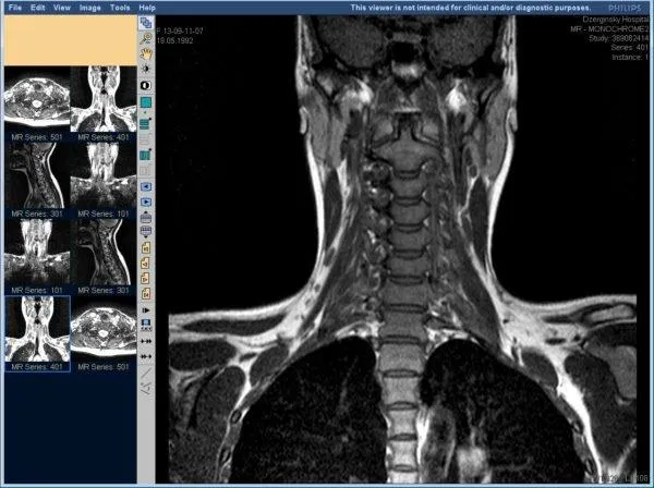 Магнитная томография шейного отдела позвоночника и глоточного отдела позвоночника