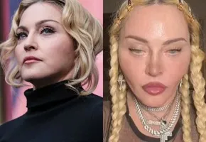 Что за процедура превратила Мадонну в человекоподобную куклу?