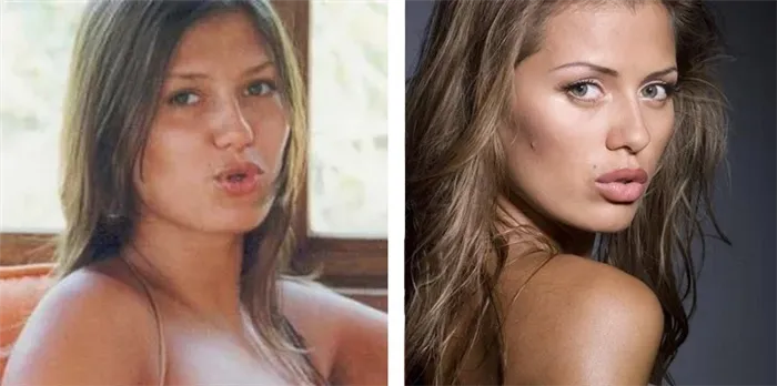 ViktoriaBonya до и после пластической операции