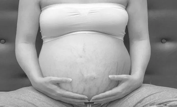 У многих женщин во время беременности появляются растяжки