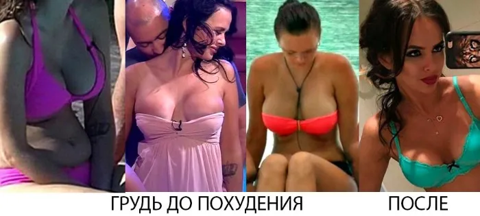 Виктория Романец до и после операции на груди; фото, вес и рост, физические параметры. Изменения после потери веса, хирургического вмешательства.