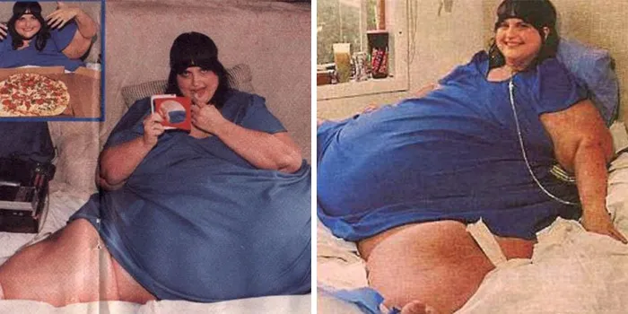 Год Кэрол - самой толстой женщины в мире