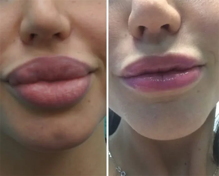 красивые губы