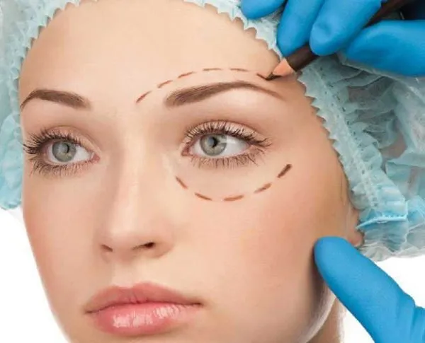 Лисий взгляд (глаза) у девушек: операция, макияж, косметология