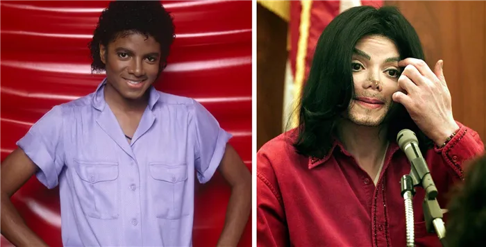 Сравните фото Майкла Джексона в молодости и в конце жизни