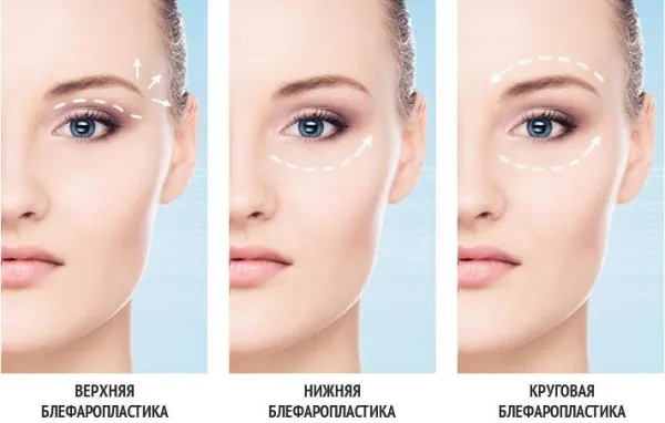 Глубоко посаженные глаза. Фото, что означает, как определить, исправить у женщин: макияж, пластика, операция