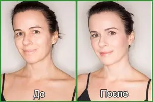 Фото до и после крема-лифтинга для лица