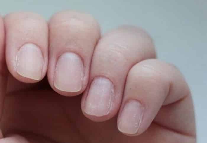 Ногти после снятия геля